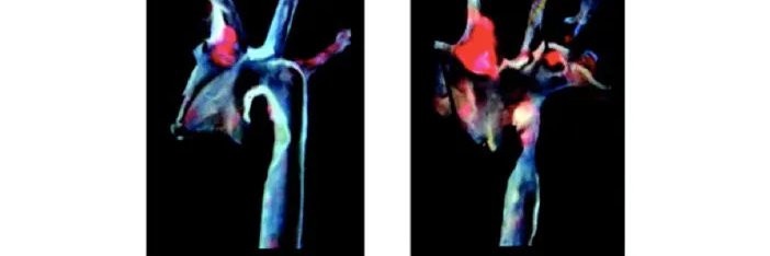 Claudia Monaco Lab - Cardiovascular Inflammation banner