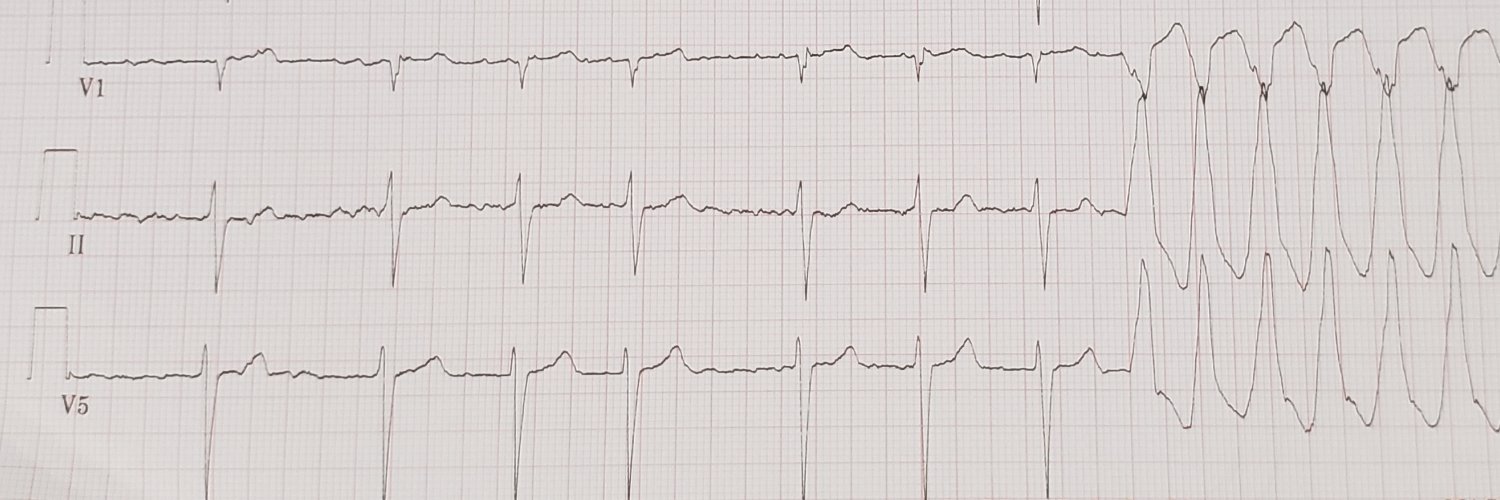 Millard Craft banner