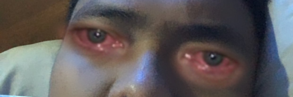 🧟‍♂️ banner