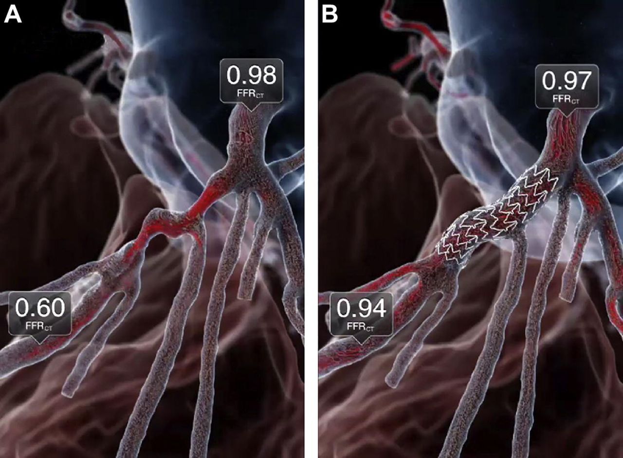 Allen Jeremias banner