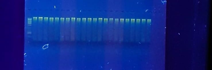 Degsew Zerihun banner