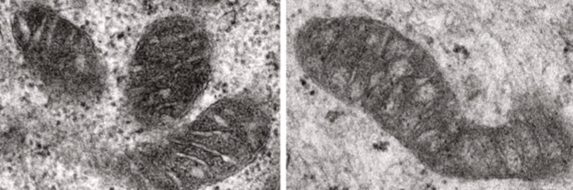 Gilles Rademaker banner