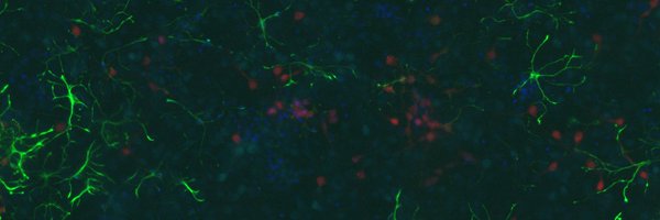 alexafluor532 Profile Banner