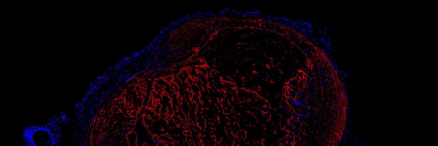 Angelina Kraechan banner