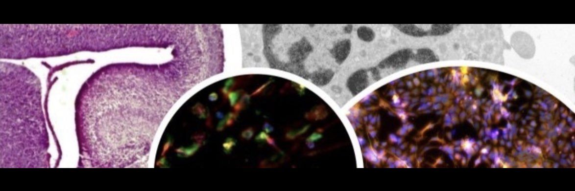 Neuroimmune Interactions Laboratory @UMASS's banner