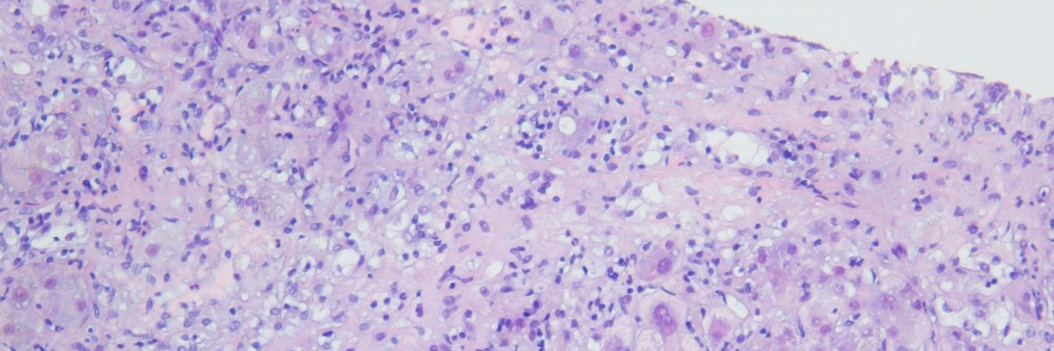 ClinicLiverCases banner