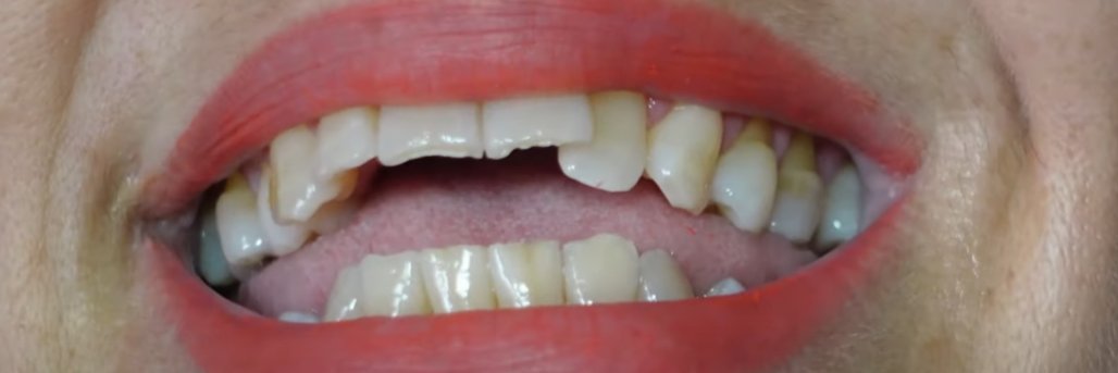 L'ex meilleure amie du Québec Mélissa banner