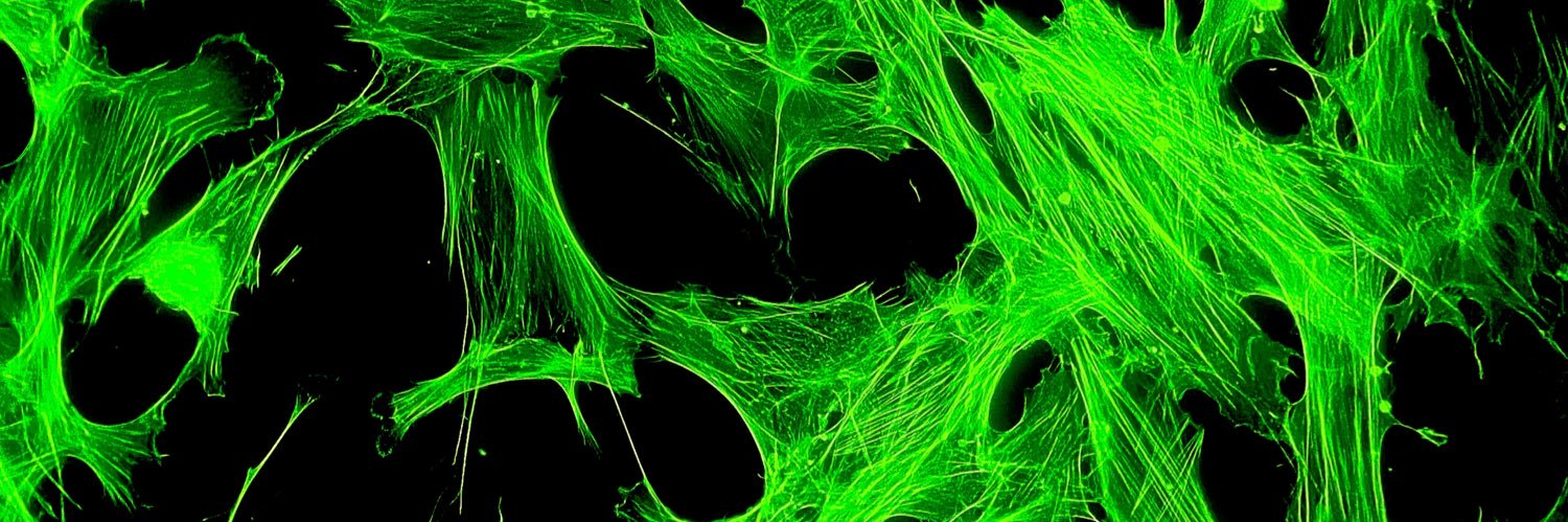 Freddie Braddock banner