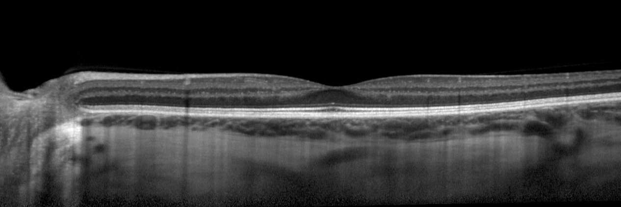 Christine A. Curcio PhD banner