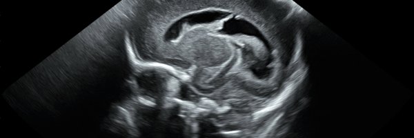 SonoSim Profile Banner