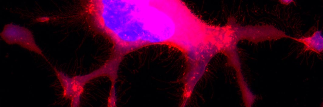 Vincent Ehreiser banner