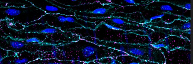 Brooke O’Donnell banner