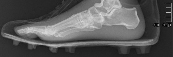 AtholThomson Profile Banner