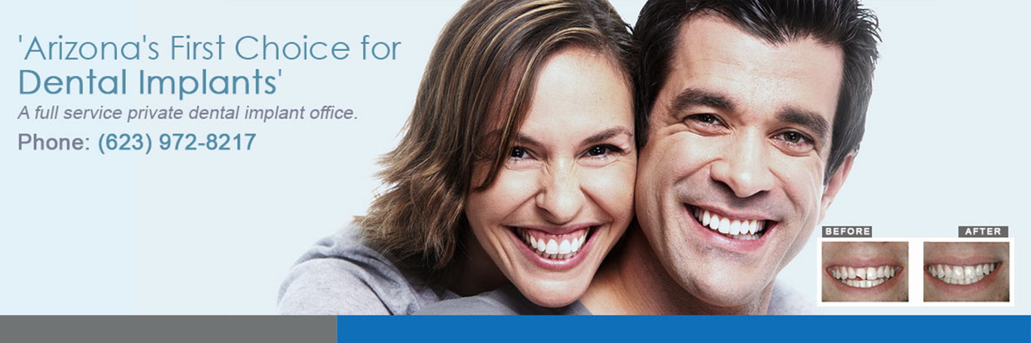 teethimplantsaz's profile banner image