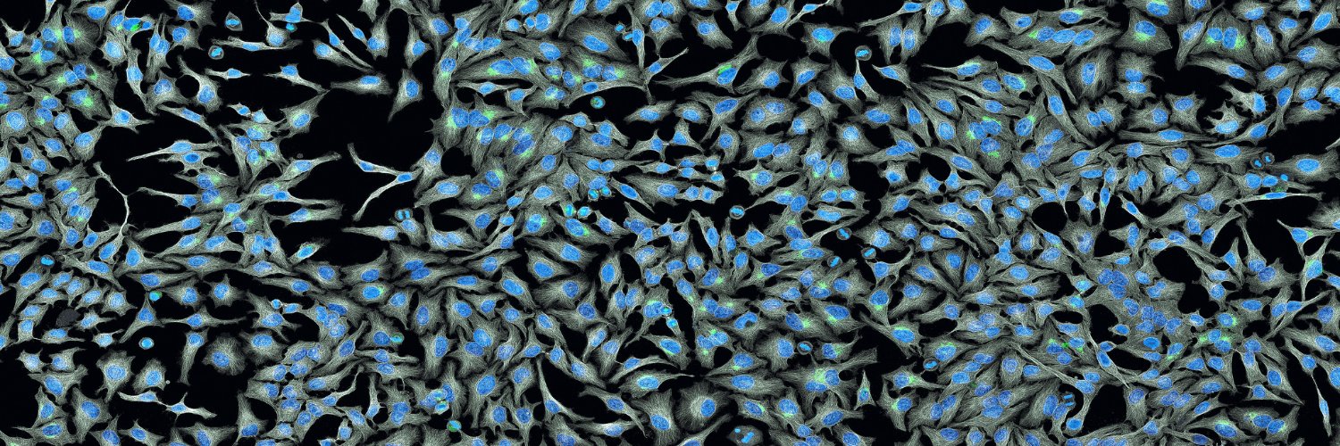 Conexión Cáncer CSIC banner