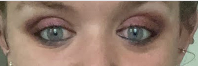 Ashley’s Pinpoint Pupils banner
