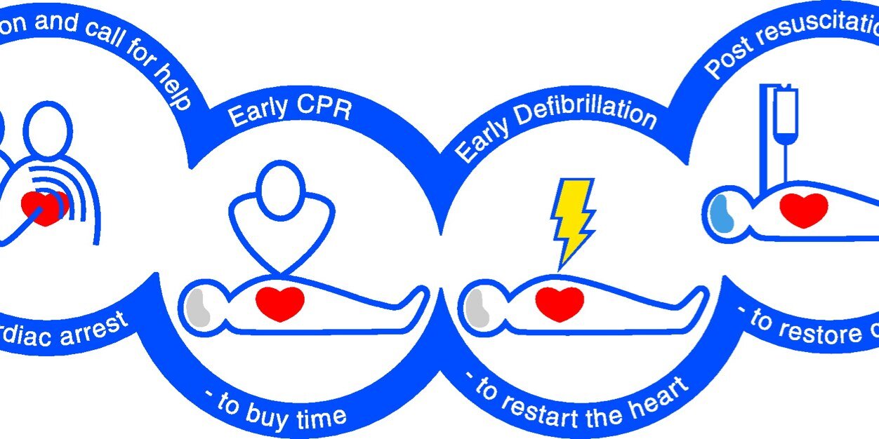 UHCW Resuscitation Service banner