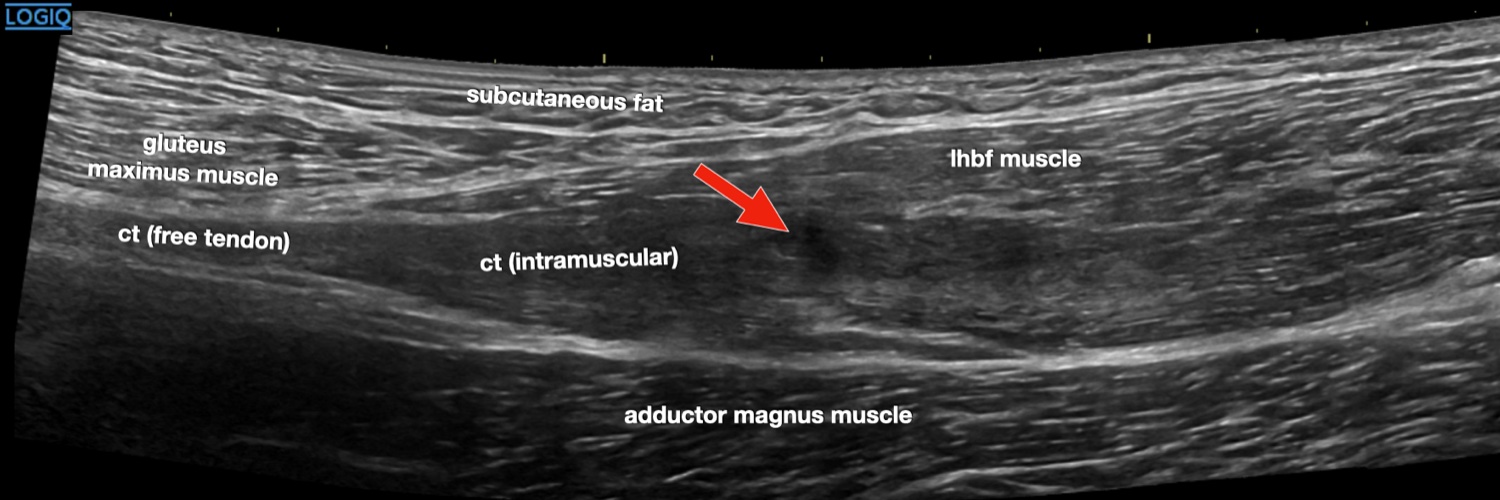 Ultrasound Imaging's banner