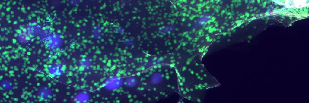 Andreas Meyer banner