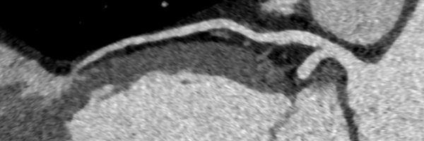 tassimes Profile Banner