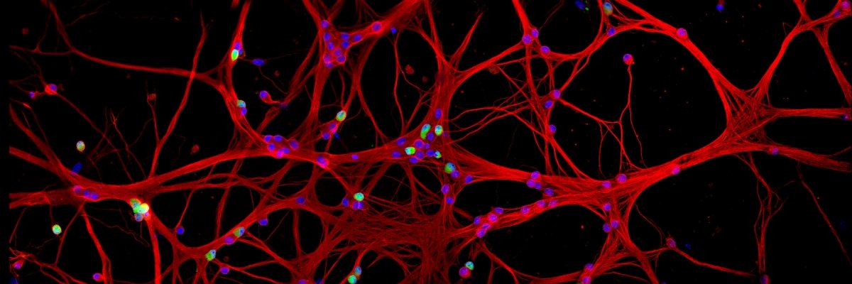 Sara Azimi, PharmD, BCIDP banner