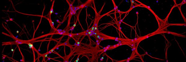 SaratoninSyndrm Profile Banner