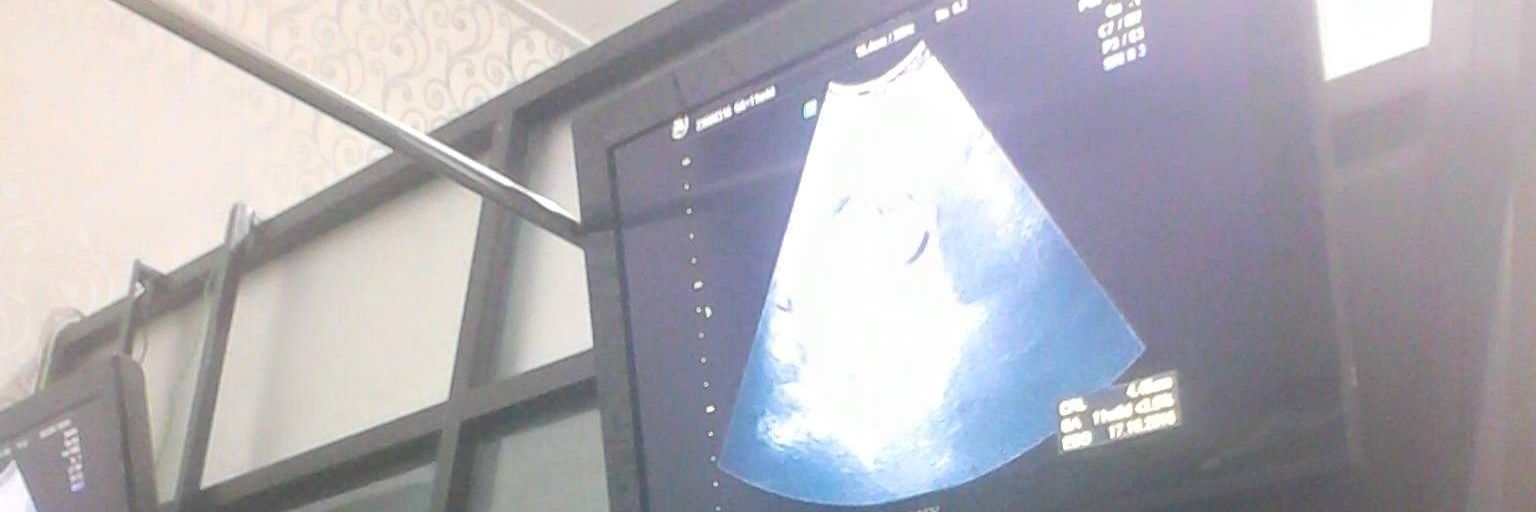 Chesilia Pertiwi banner