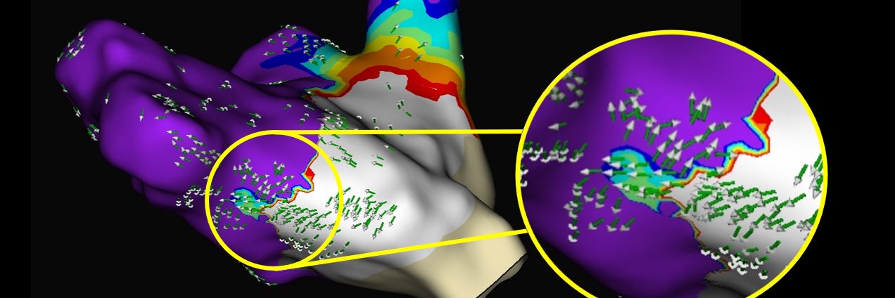 Corbyn Fulmer banner