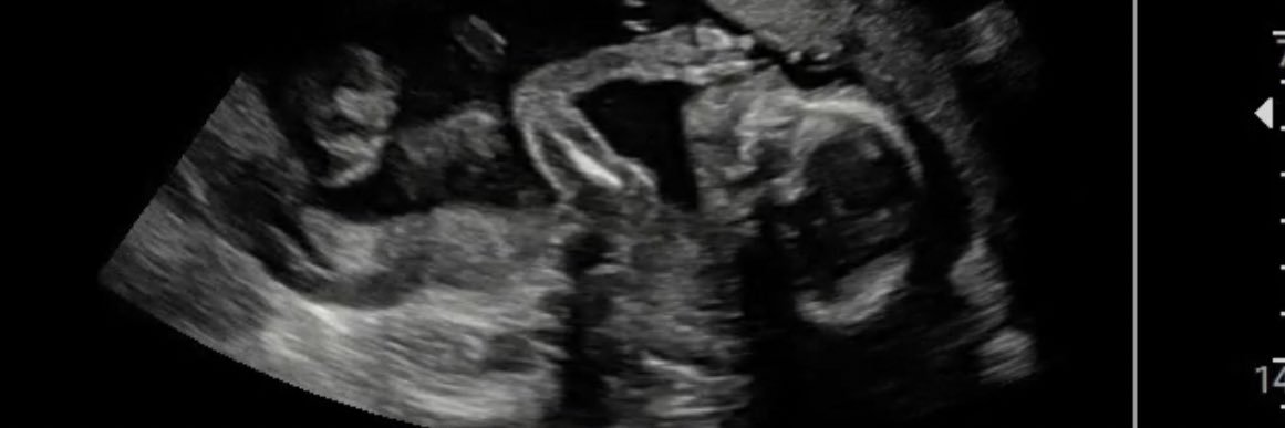 _TiaraColeman's profile banner image