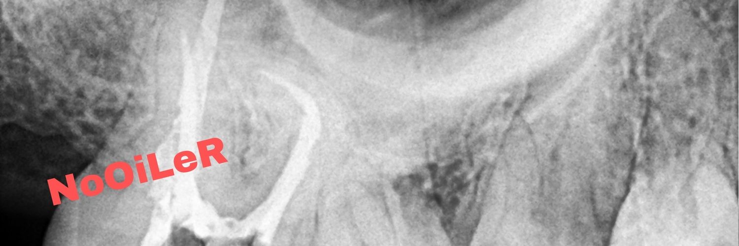 NoOiLeR banner