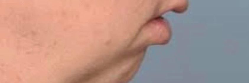 Vlad Chin Finder banner