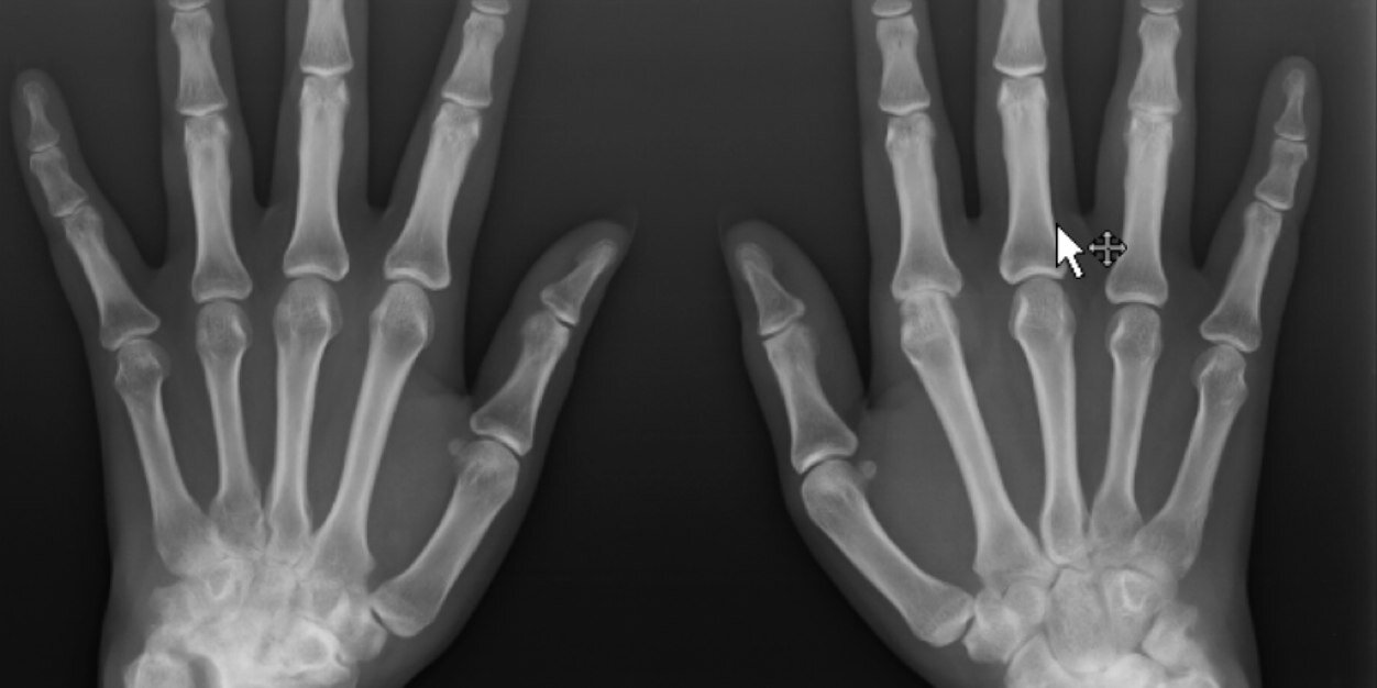 ArthritisFM's profile banner image