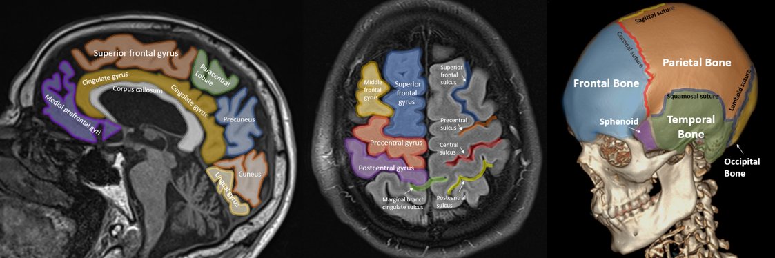 The Neuroradiologist's banner