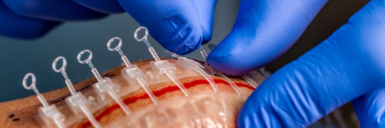 Zipline Medical, Inc (Zipline_Medical) / Twitter