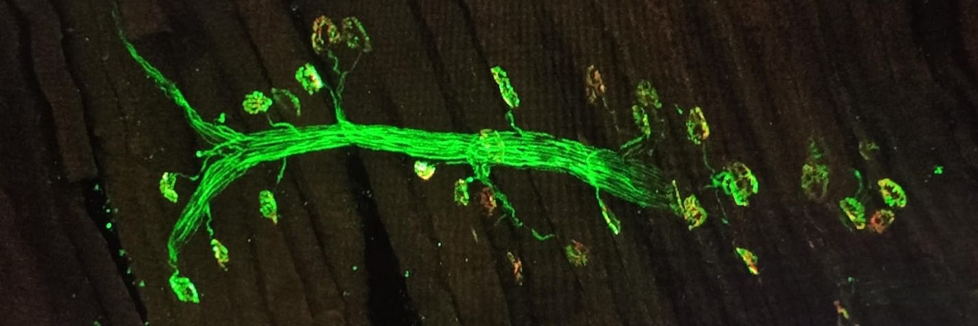 Matilde Cescon banner