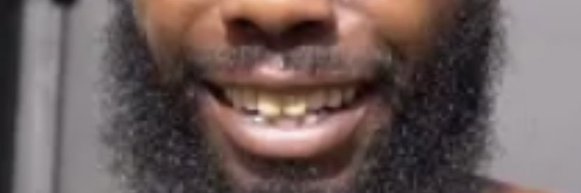 KING TOOTH 👑🦷 banner