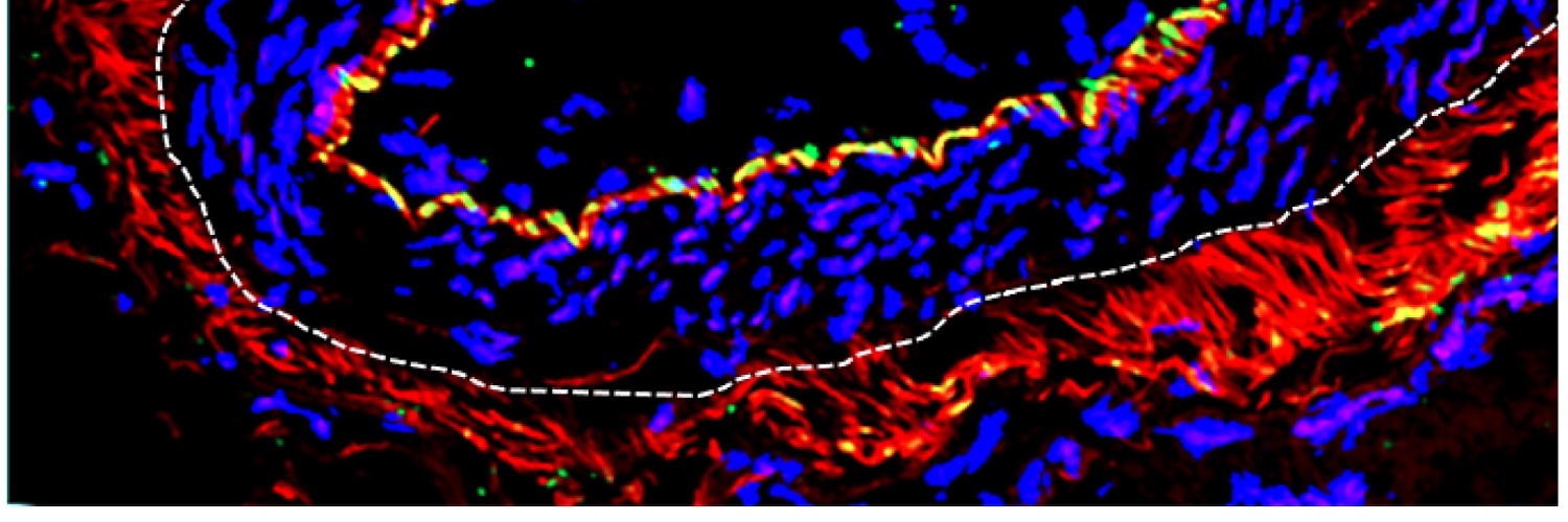 Neelima Thottappillil banner