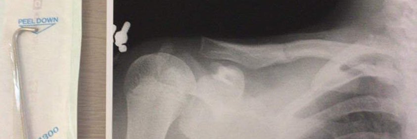 鎖骨くらっしゃー banner