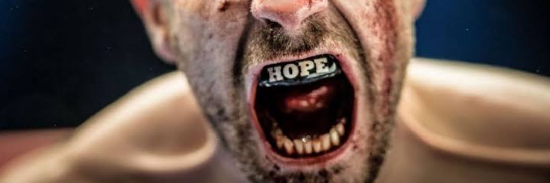 billy hope banner