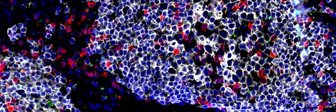 Host-Microbe Interactions banner