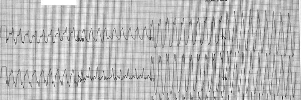 CardiacChazz Profile Banner