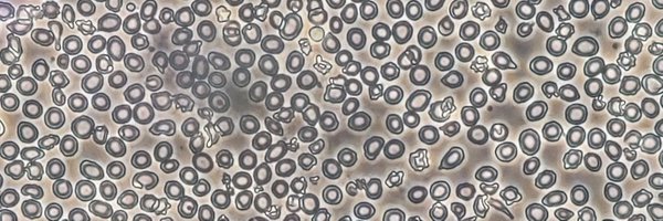 Prathibhapbc Profile Banner