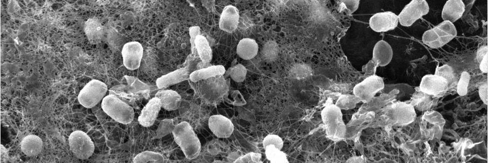 Microbiología y Tecnología Ambiental, UGR's banner