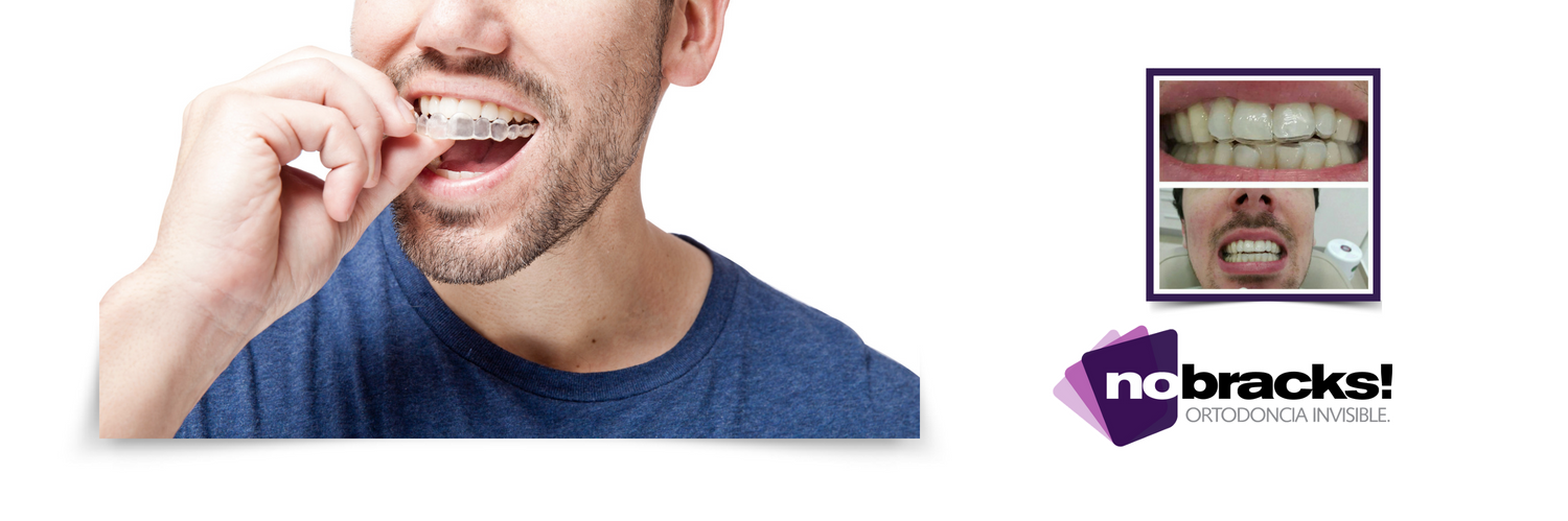 Nobracks's profile banner image