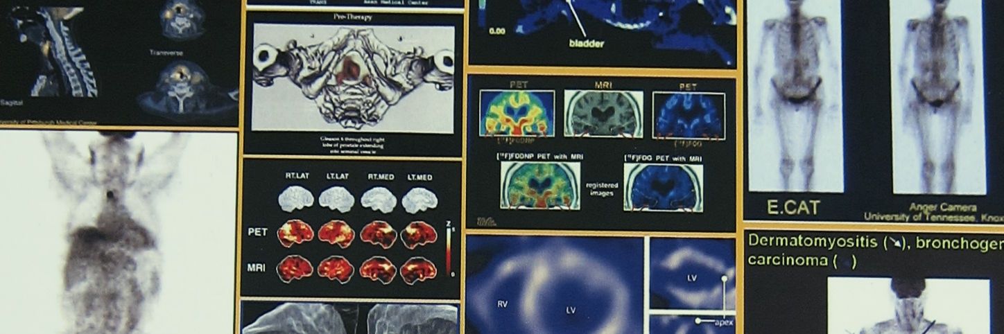 The Pillarsetty Lab @ MSK banner