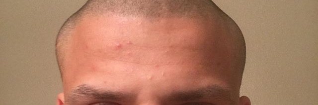 Tyler1 Updates banner