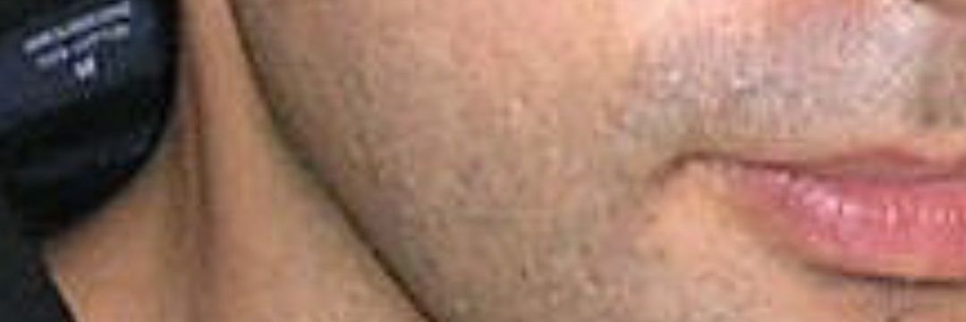 Alex Inguanzo banner