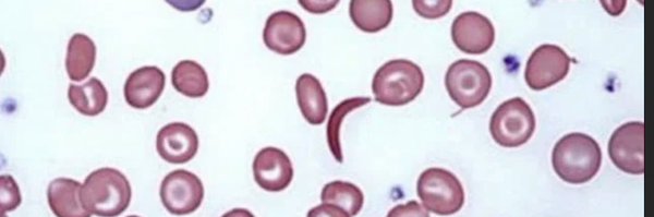 pedshemepulmdoc Profile Banner