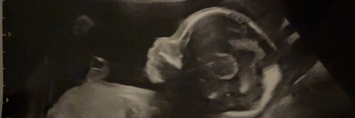 32Thang's profile banner image