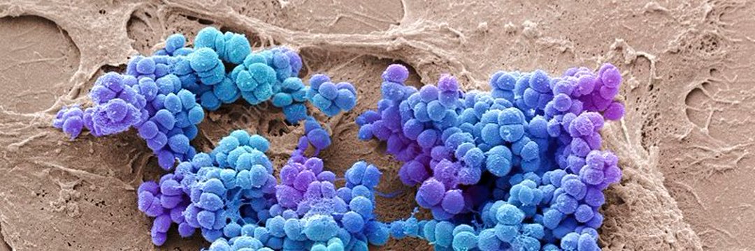 🟨 T h o r s t e n banner